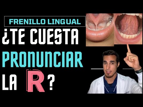 Cómo dominar la pronunciación de la letra r en español